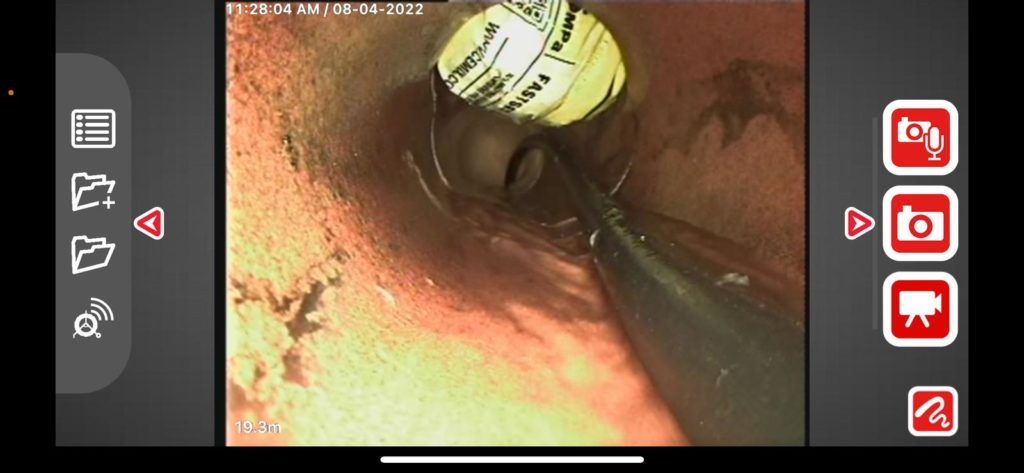 This CCTV inspection found a concrete bag inside the drainage pipe